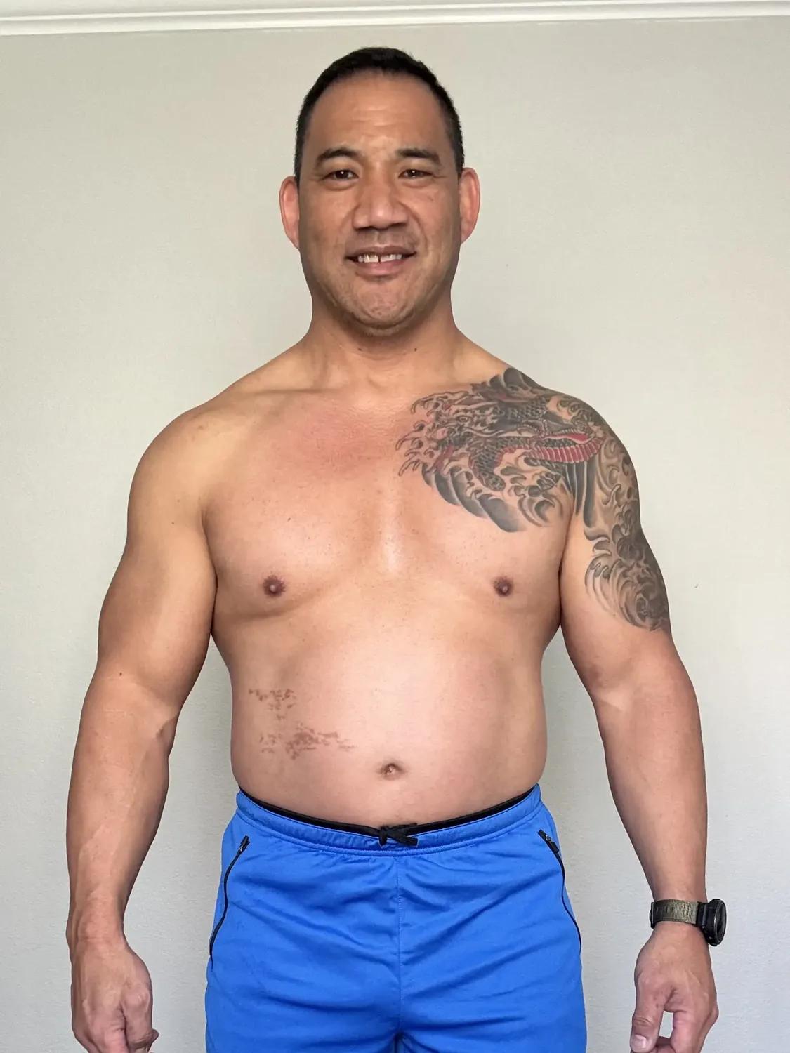 Johnny M. before photo
