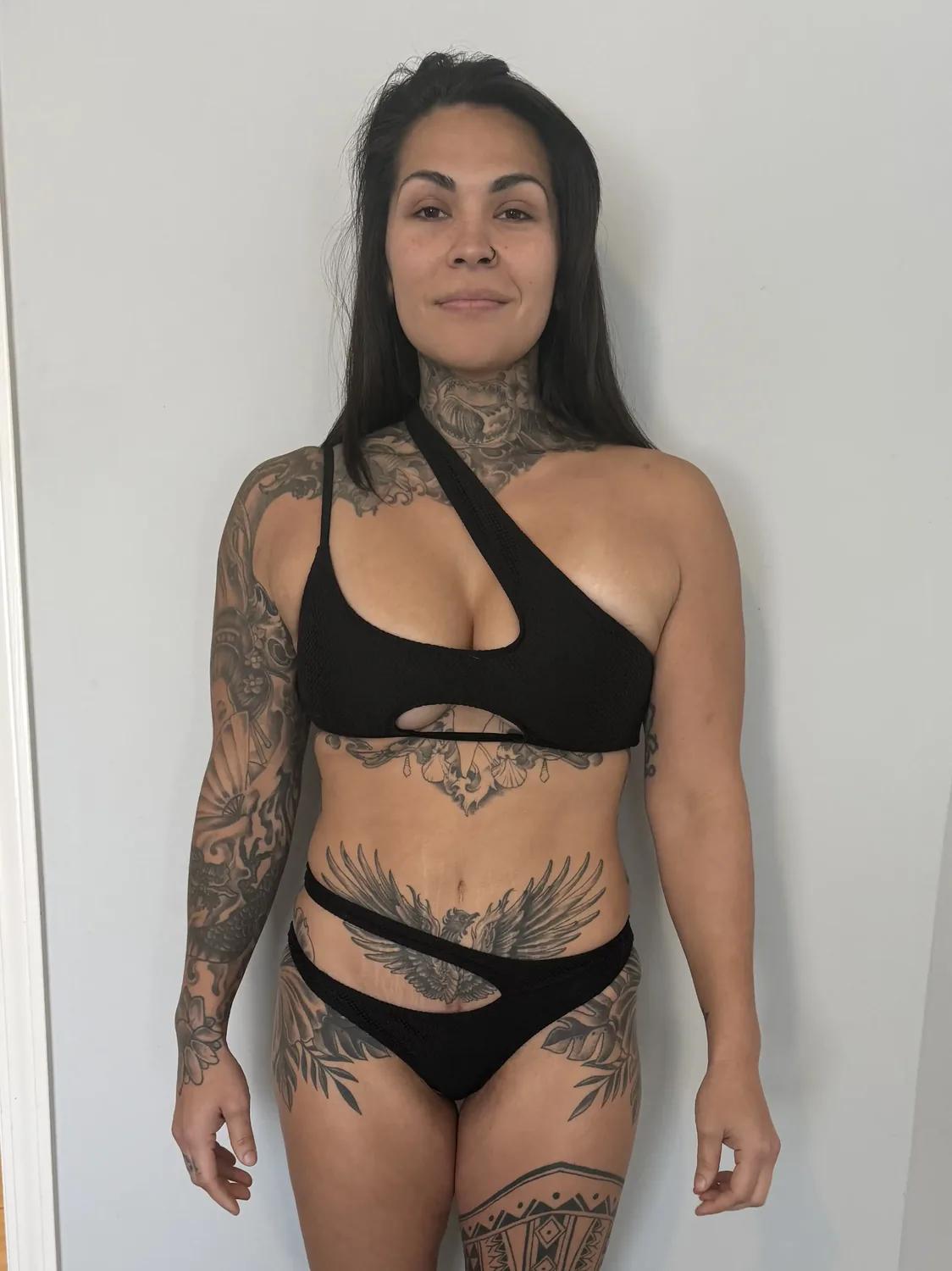 Alyssa S. before photo