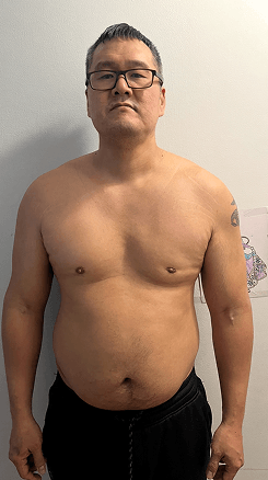 Client before