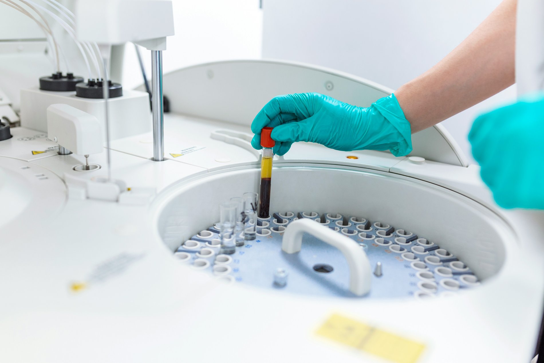 Micronutrient Testing: Why It Matters for Health Optimization-image