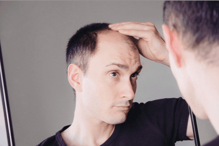 Supplements That Help Counteract Hair Loss -image