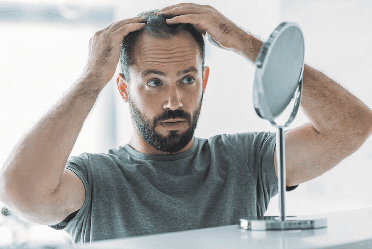 Comparing Finasteride and Dutasteride for Hair Loss Treatment-image