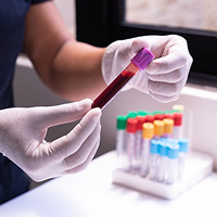 Advanced blood work